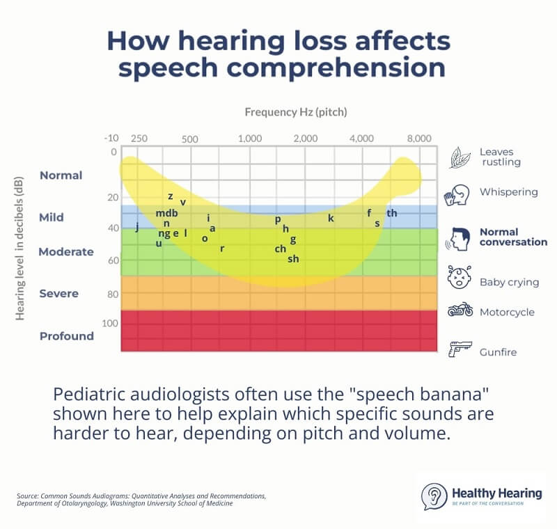 Pediatric speech banana example, as shown on audiogram